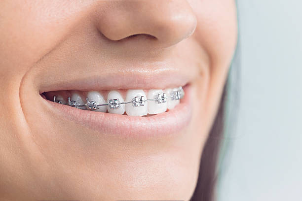 Best Full Mouth Reconstruction  in Herald Harbor, MD